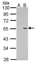 PKNOX1 Antibody in Western Blot (WB)