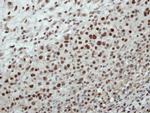 CSTF2 Antibody in Immunohistochemistry (Paraffin) (IHC (P))