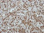 ZNF187 Polyclonal Antibody