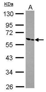 ZNF187 Antibody in Western Blot (WB)