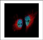 hnRNP M Antibody in Immunocytochemistry (ICC/IF)