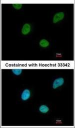 CNOT3 Polyclonal Antibody