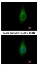 IMPA1 Polyclonal Antibody