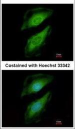 PLCD1 Antibody in Immunocytochemistry (ICC/IF)