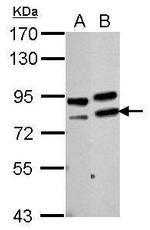 PARN Polyclonal Antibody