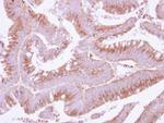 COX15 Polyclonal Antibody