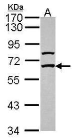 GABRE Polyclonal Antibody