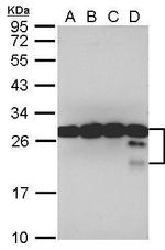 TPD52 Antibody in Western Blot (WB)