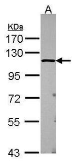 USP5 Antibody in Western Blot (WB)