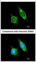 AKAP1 Polyclonal Antibody
