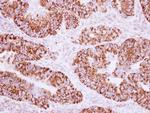 AKAP1 Antibody in Immunohistochemistry (Paraffin) (IHC (P))