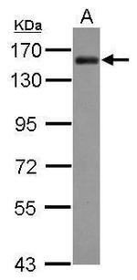 AKAP1 Antibody in Western Blot (WB)