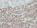 SF3A2 Antibody in Immunohistochemistry (Paraffin) (IHC (P))