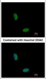 RBM10 Polyclonal Antibody