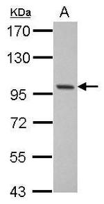 RBM10 Antibody in Western Blot (WB)
