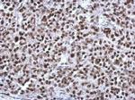 CGGBP1 Polyclonal Antibody