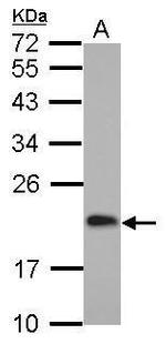 CGGBP1 Antibody in Western Blot (WB)