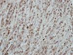 RRP1 Antibody in Immunohistochemistry (Paraffin) (IHC (P))
