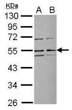 RRP1 Polyclonal Antibody