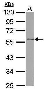 DLK1 Polyclonal Antibody