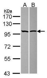 ASAP2 Polyclonal Antibody