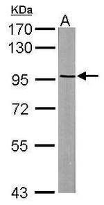 ASAP2 Antibody in Western Blot (WB)