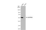 ALDH1A2 Polyclonal Antibody