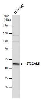 ST3GAL5 Antibody in Western Blot (WB)