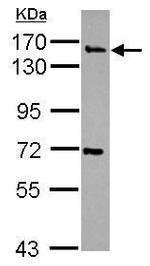 Synaptojanin 2 Polyclonal Antibody