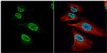 FUBP1 Antibody in Immunocytochemistry (ICC/IF)