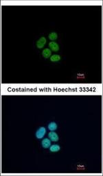 FUBP1 Antibody in Immunocytochemistry (ICC/IF)