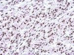 FUBP1 Antibody in Immunohistochemistry (Paraffin) (IHC (P))