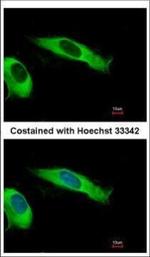 eIF2 beta Polyclonal Antibody