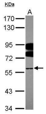 FUBP3 Antibody in Western Blot (WB)