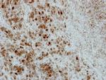 PRC1 Antibody in Immunohistochemistry (Paraffin) (IHC (P))
