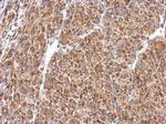 PIAS2 Antibody in Immunohistochemistry (Paraffin) (IHC (P))