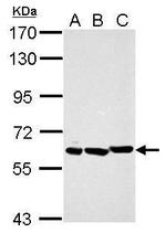 PIAS2 Antibody in Western Blot (WB)
