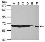 PIAS2 Antibody in Western Blot (WB)