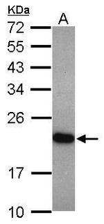UNC119 Polyclonal Antibody