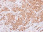 USP14 Antibody in Immunohistochemistry (Paraffin) (IHC (P))