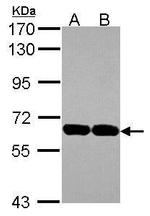 USP14 Antibody in Western Blot (WB)