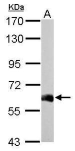 USP14 Antibody in Western Blot (WB)