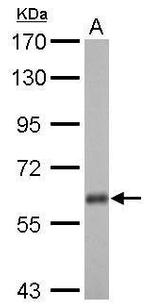 USP14 Antibody in Western Blot (WB)