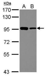DDX21 Antibody in Western Blot (WB)