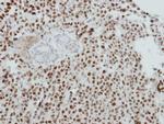 MTA2 Polyclonal Antibody