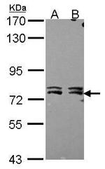 MTA2 Antibody in Western Blot (WB)
