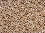 BCL7C Antibody in Immunohistochemistry (Paraffin) (IHC (P))