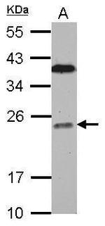 BCL7C Antibody in Western Blot (WB)