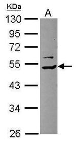 TRIP15 Polyclonal Antibody