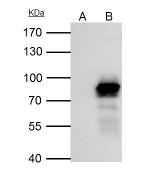 Placental Alkaline Phosphatase Antibody in Immunoprecipitation (IP)